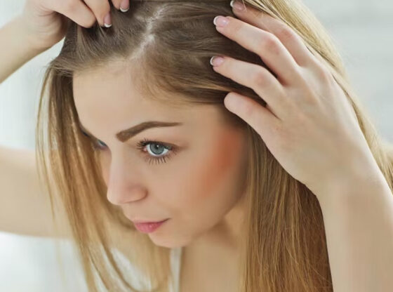 Hair Loss Treatment